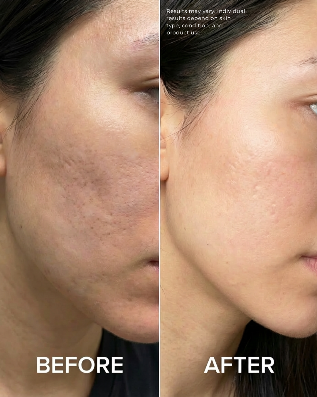 Pigment Perfecting Serum